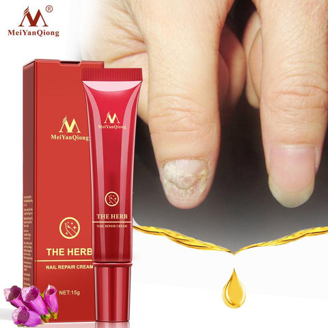 Vanish Nail Treatment Cream - DogCore.com