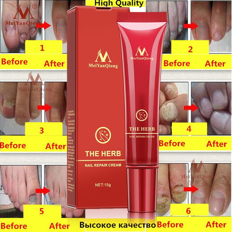 Vanish Nail Treatment Cream - DogCore.com